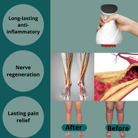 NERVALYNE™ The natural, technological solution to nerve, muscle and joint pain